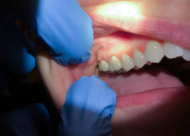 Best Pediatric Emergency Dentist in Oak Ridge, NC