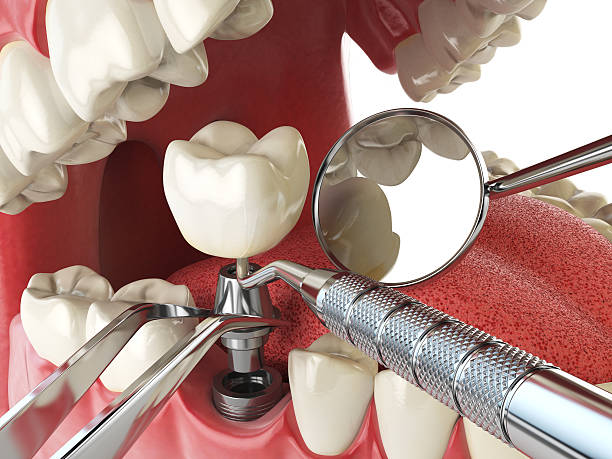 Best Emergency Dentist for Knocked-Out Tooth in Oak Ridge, NC